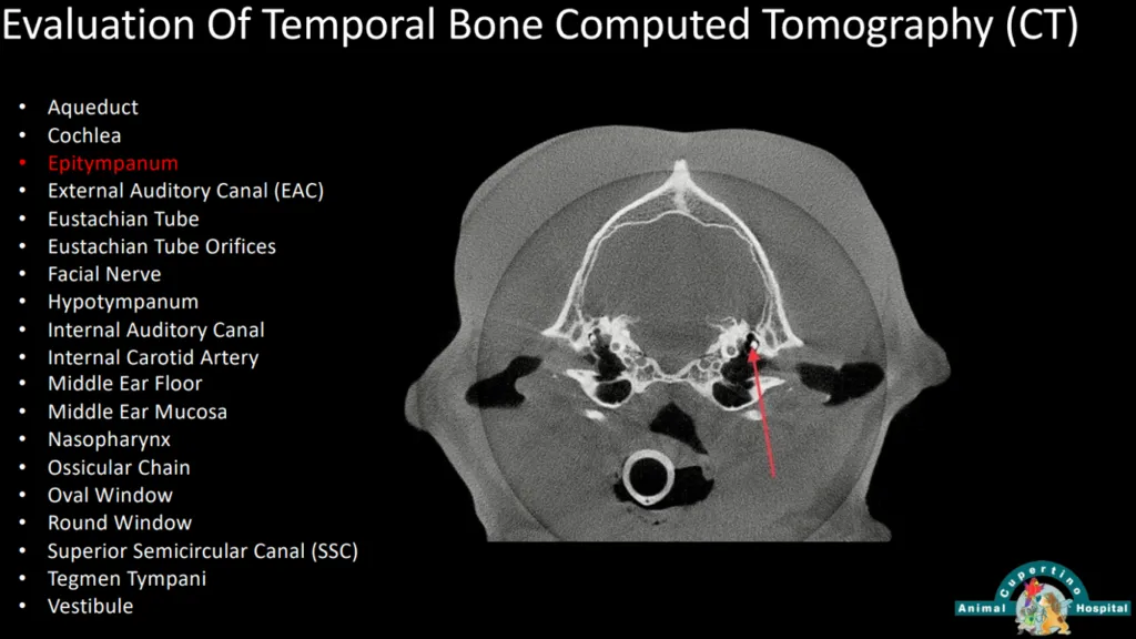 Evaluation-Of-Temporal-Bone-Computed-Tomography-CT-