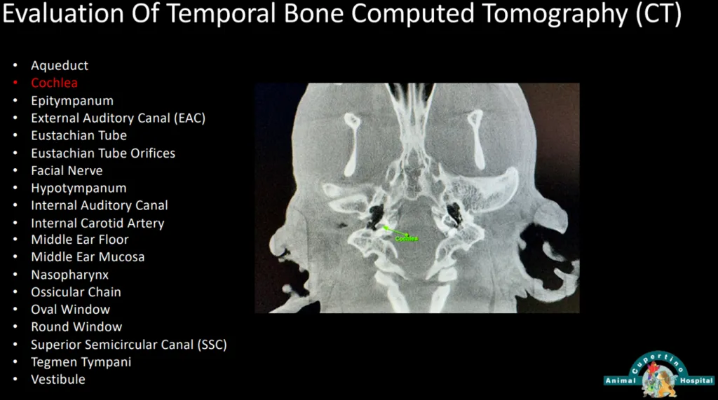 Evaluation-Of-Temporal-Bone-Computed-Tomography-CT