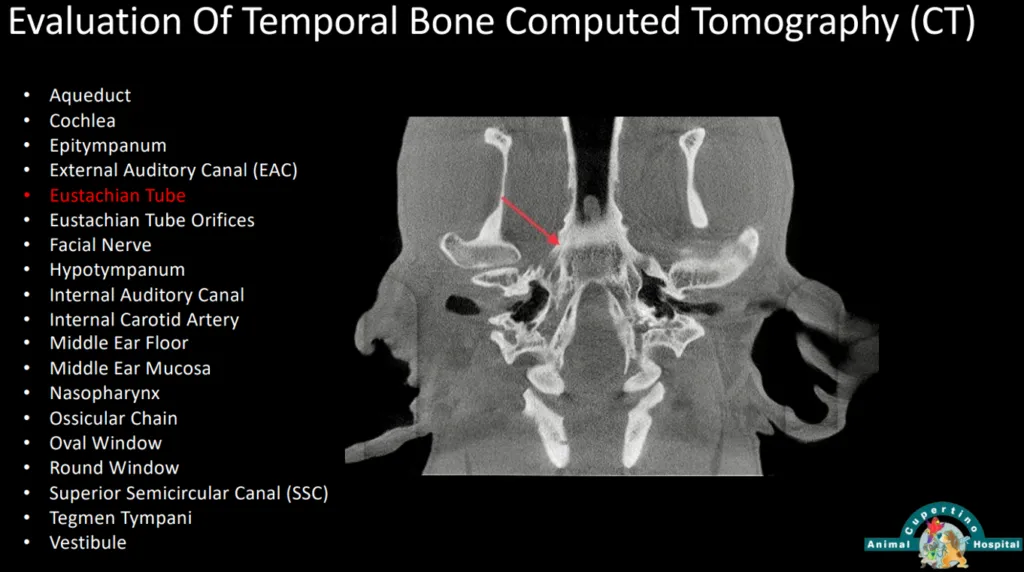 Evaluation-Of-Temporal-Bone-Computed-Tomography-CT